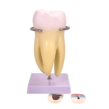 2022 Новая стоматологическая модель зубов для установки в клинике и общения врача с пациентом